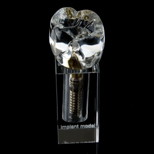 高品質歯科インプラントM2019-II展示用透明模型