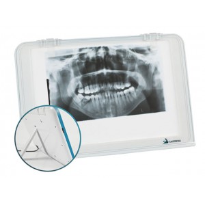 HISHINE® L-Luna小型シャウカステン歯科X線画像読取装置