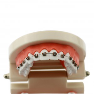 歯科矯正治療説明用メタルブラケット180度開閉式上下額