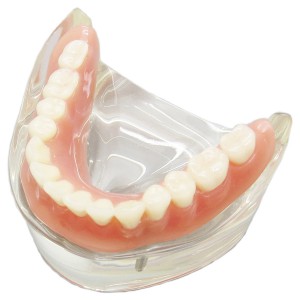 歯科下顎インプラントモデル取り外し可能 高品質歯科インプラント研究治療説明用歯列模型 2本釘 透明 クリアベース