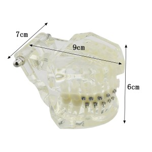 歯列矯正治療説明用 ブラケットモデル セラミックメタル上下顎 模型 クリアベース