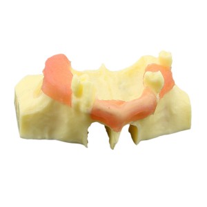 歯科上顎洞底挙上術練習用模型 サイナスリフト ソケットリフトイエローベース