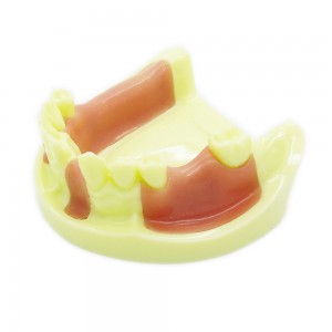 歯科下顎義歯模型 インプラント研究練習用道具 イエローベース