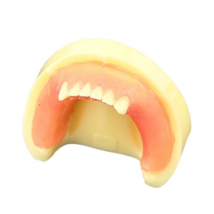 歯科下顎模型インプラント研究練習用標準教学道具 イエローベース