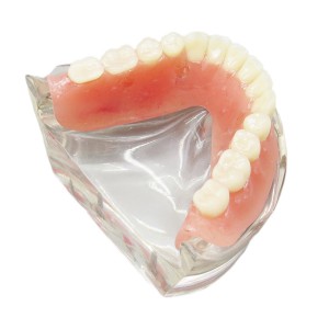 歯科下顎インプラント用模型 研究治療説明用4本インプラント脱着可能クリアベース 透明