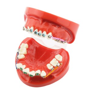 歯科上下顎180度開閉式歯列矯正模型治療用研究用 ブラケットモデル パワーチェーン装着