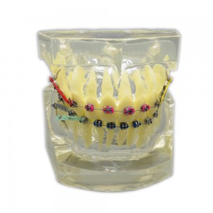 歯科上下顎180度開閉式歯列矯正模型治療用研究用 ブラケットモデル パワーチェーン装着