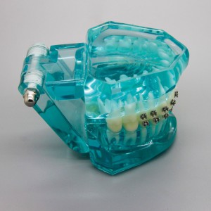 歯科矯正治療模型金属セラミック舌側ブラケット付き3009