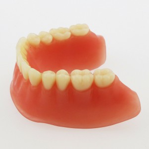 歯科下歯義歯模型4本インプラント オーバー デンチャー 下顎模型