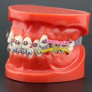 歯科矯正治療説明用研究用金属ブラケット アーチワイヤーチェーン付き