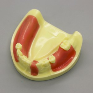 歯科模型下顎インプラント練習モデル 歯肉付き #2004 01