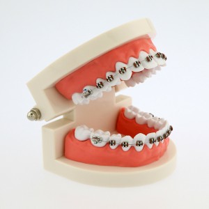 歯科矯正模型研究教学用ブレース付き 5006