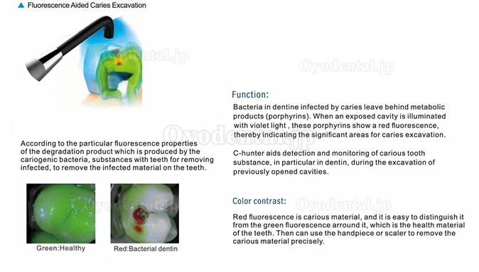 YUSENDENT®歯科用虫歯診断装置ダイアグノデントペン(歯面状態認識装置)C-hunter