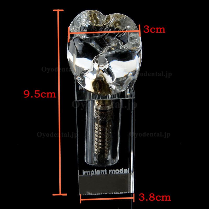 高品質歯科インプラントM2019-II展示用透明模型