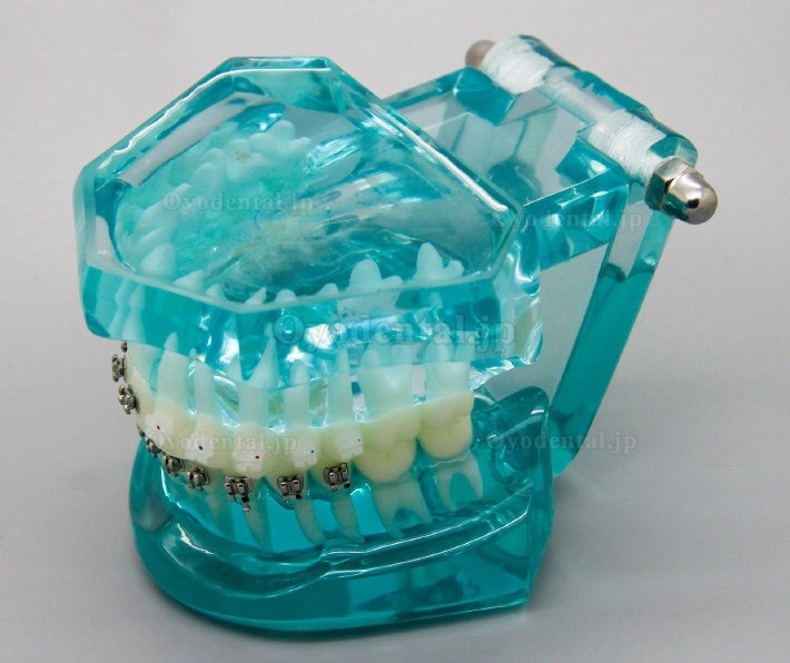 歯科矯正治療模型金属セラミック舌側ブラケット付き3009
