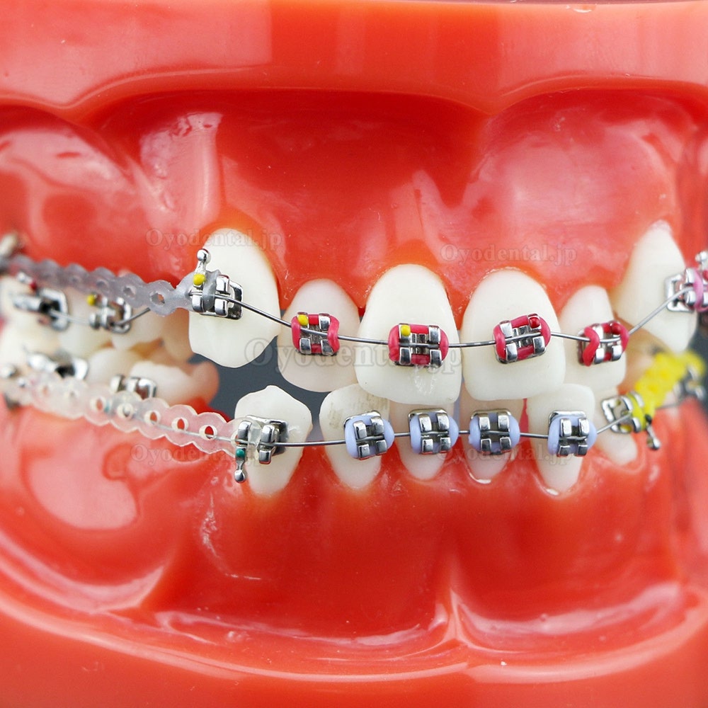 歯科矯正治療説明用研究用金属ブラケット アーチワイヤーチェーン付き