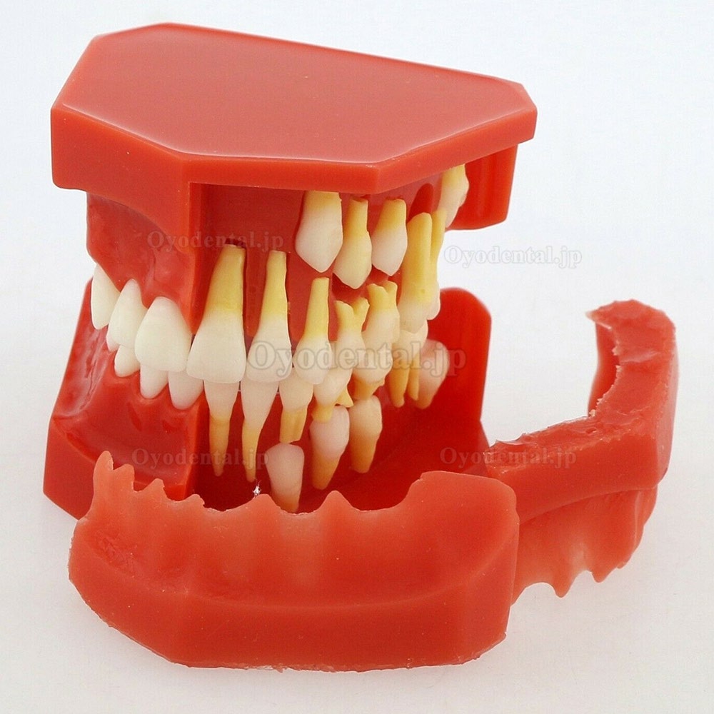 歯列モデル永久歯デモンストレーション教学研究用模型4006#