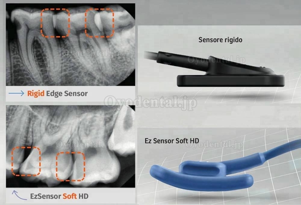 VATECH EZSensor ソフトタイプデジタル歯科用X線センサー