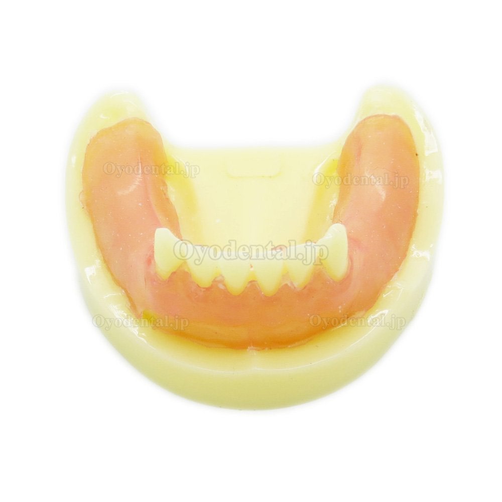 歯科下顎模型インプラント研究練習用標準教学道具 イエローベース
