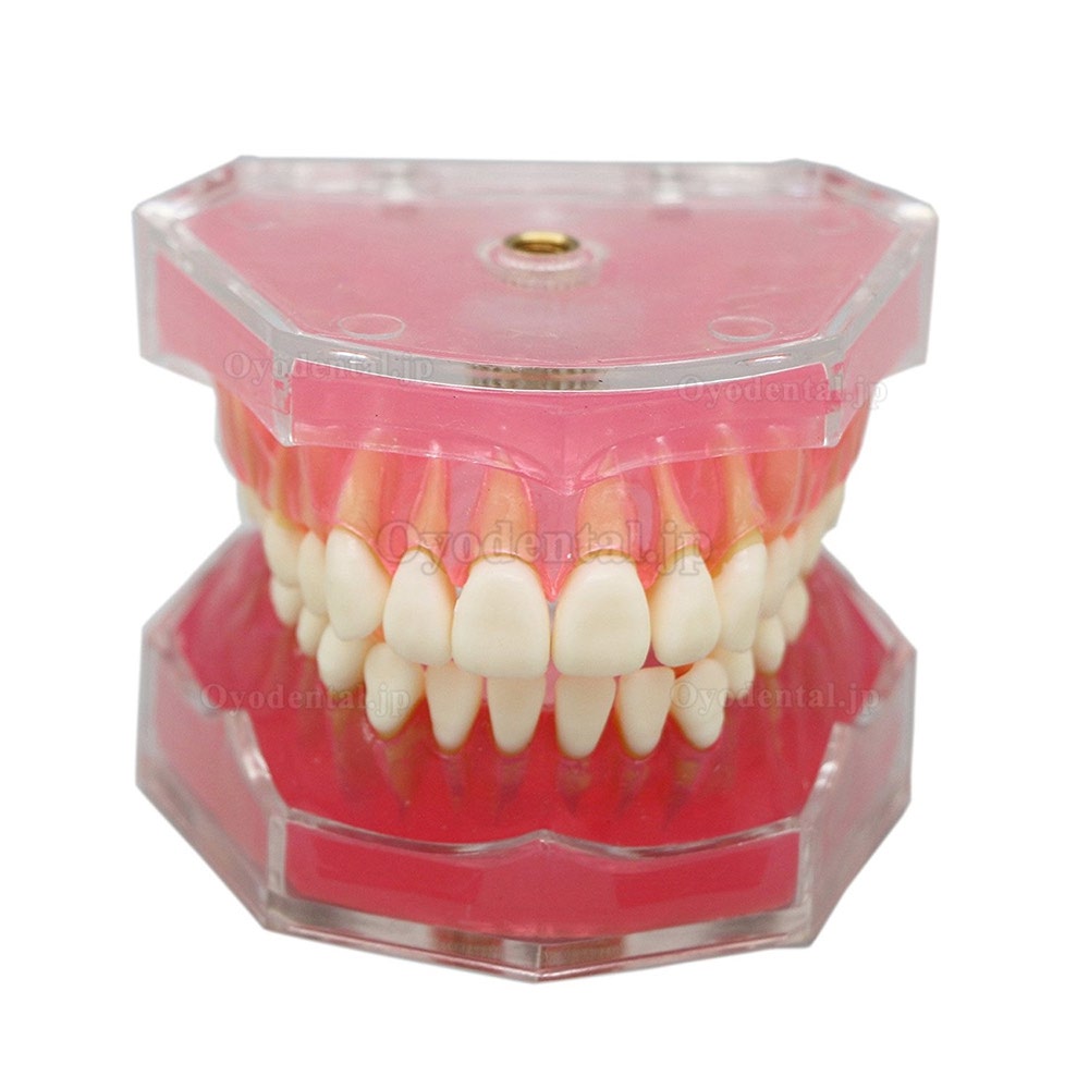 歯科研究治療説明用上下顎義歯模型脱着可能歯列模型 実用的 クリアベース ピンク